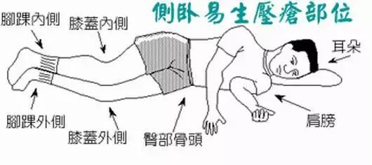 为卧床老人翻身预防压疮,预防老年人压疮护理方法