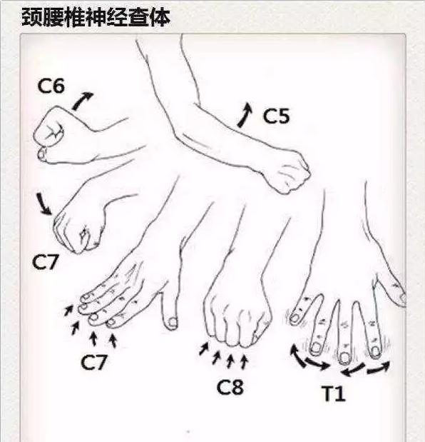 医生看颈椎病的图片,颈椎胸椎腰椎尾椎图解全图