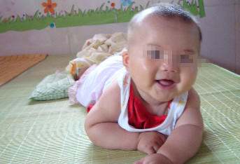 2岁男童少了一个蛋蛋,宝妈惊慌不知所措