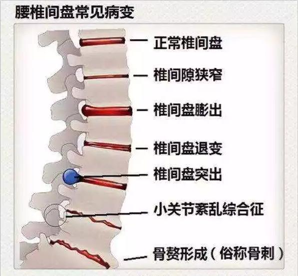医生看颈椎病的图片,颈椎胸椎腰椎尾椎图解全图