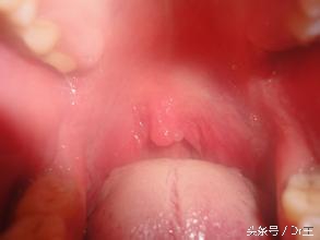 胃胀打嗝胸闷气短放屁吃啥药,吃完饭就胃胀打嗝胸闷堵得慌