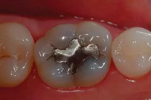 治口气挂什么科,口气臭挂号挂什么科