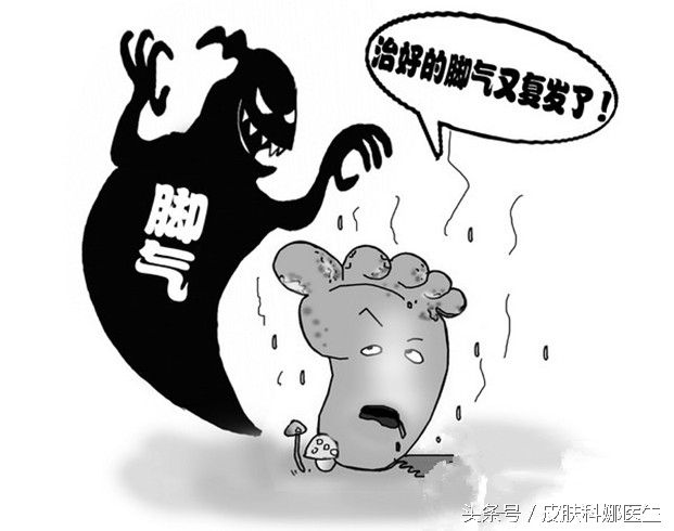 治疗足癣要特别注意问题有哪些,足癣非常严重了怎么治疗