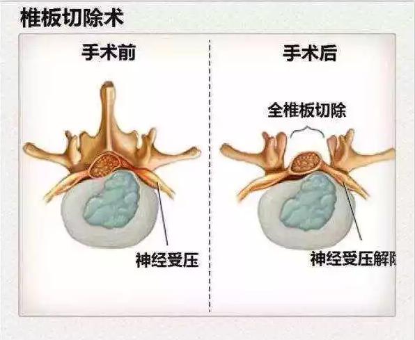 医生看颈椎病的图片,颈椎胸椎腰椎尾椎图解全图