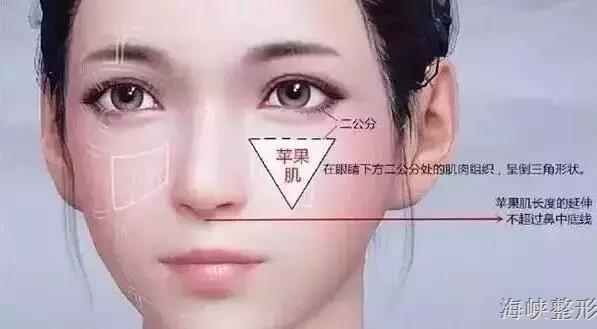 玻尿酸丰脸颊亲身经历,玻尿酸丰太阳穴脸变大了