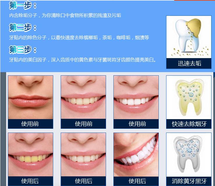 抗老紧致美容仪推荐,美容仪器测评美妆品牌