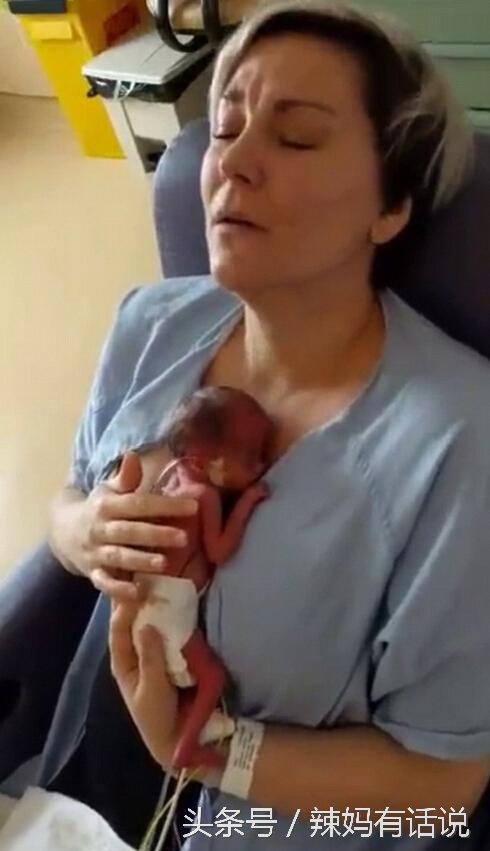 孕33周胎膜早破早产胎儿的成活率,孕妈妈早产会有哪些迹象