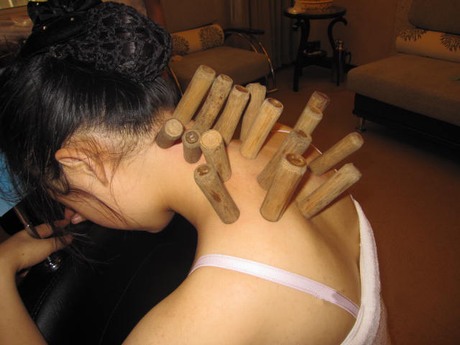 竹罐儿御医的非遗传承之路