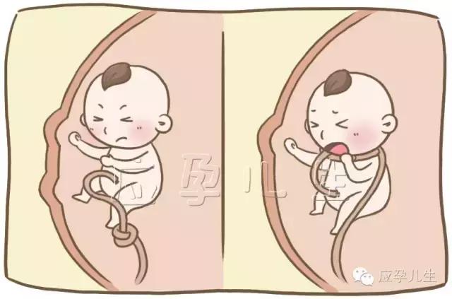 宝宝在肚子胎动的几种表现,什么样的胎动说明宝宝饿了