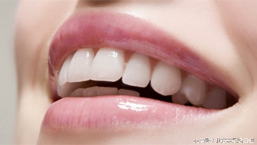 镶一口烤瓷牙到底好不好,镶的烤瓷牙有什么不习惯的吗