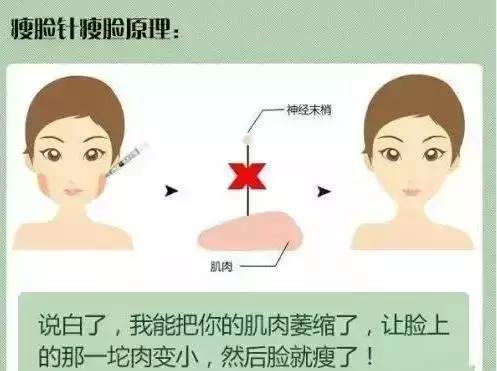 瘦脸针3d科普,科普瘦脸针打三次真的能定型吗