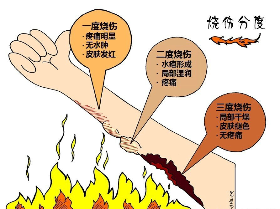 火灾后遗症解决方案,火灾后遗症怎么治疗