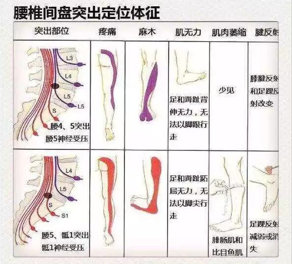 医生看颈椎病的图片,颈椎胸椎腰椎尾椎图解全图