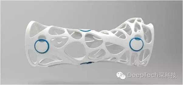 骨头断了不用打石膏，来个3D打印保护套就行，但是很贵哦