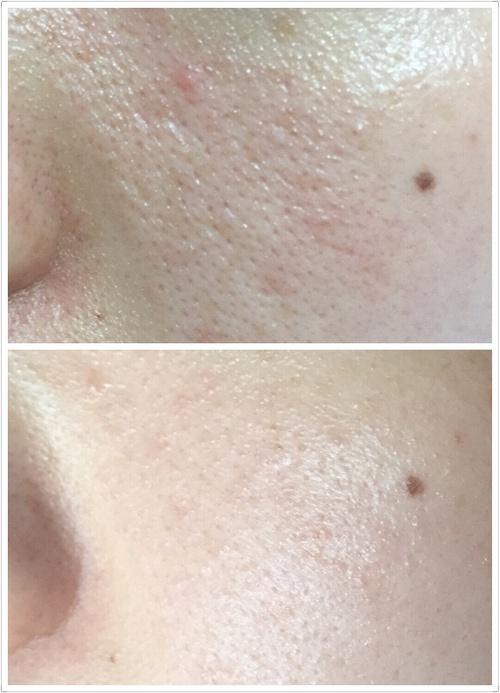 抗老紧致美容仪推荐,美容仪器测评美妆品牌