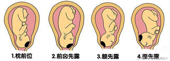胎位不正怎么睡姿可以让宝宝转好,做四维胎位不正怎么调整姿势