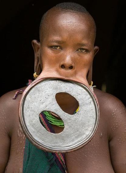 畸形矫正有后遗症吗,畸形矫正风险大吗