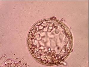 玻璃化冷冻胚胎1和2的区别,玻璃化冷冻卵