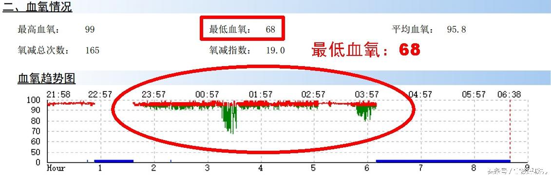 呼吸机使用纪实：把呼吸机性能发挥到极致，把健康找回来。