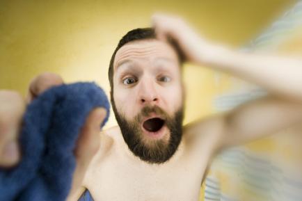 头皮脂溢性皮炎应该怎么防治,如何判断头癣和脂溢性皮炎区别