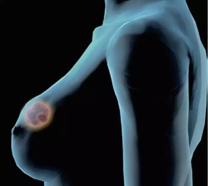 徐光炜发现抗癌中药视频,抗癌专家徐光炜如何抗癌的故事