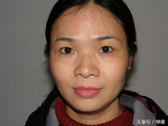 产后皮肤黑了怎么办,产后皮肤暗黄黑怎么调理