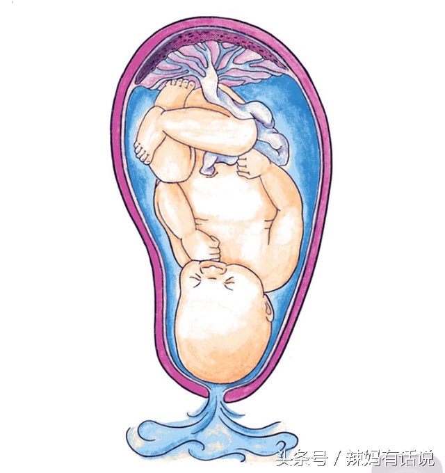 孕33周胎膜早破早产胎儿的成活率,孕妈妈早产会有哪些迹象