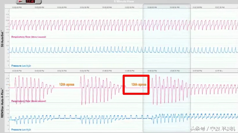 瑞思迈s9autoset-s的价格,瑞思迈s9autoset-s评测