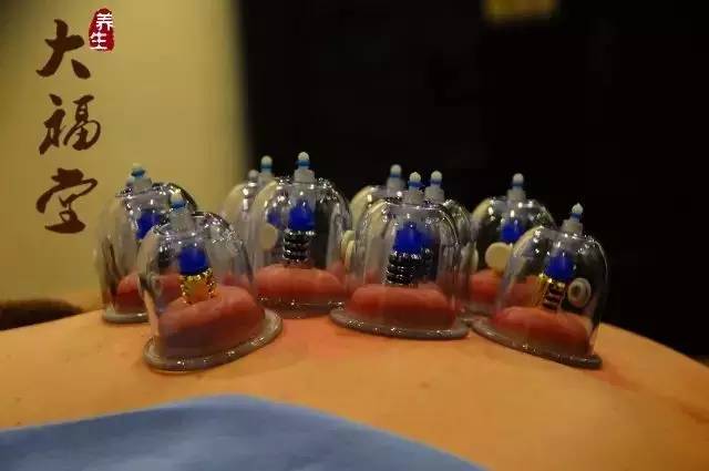 拔火罐有真空原理吗,拔火罐的来源