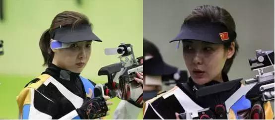 奥运冠军也爱美瘦脸箍牙后她们都美啦