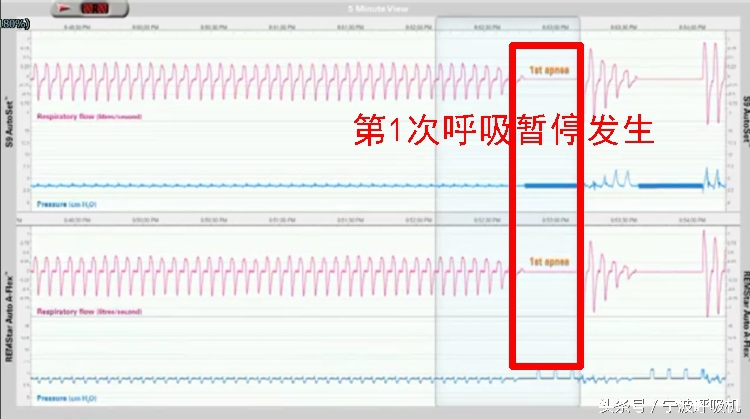 瑞思迈s9autoset-s的价格,瑞思迈s9autoset-s评测