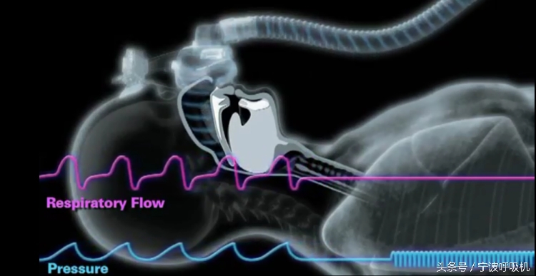 瑞思迈s9autoset-s的价格,瑞思迈s9autoset-s评测