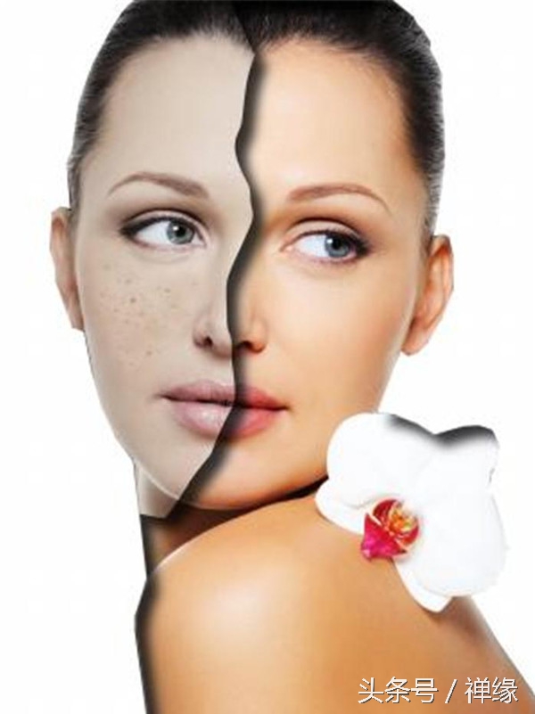 产后皮肤黑了怎么办,产后皮肤暗黄黑怎么调理