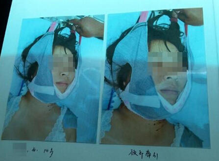 网瘾戒除游戏,网瘾大战魔兽世界