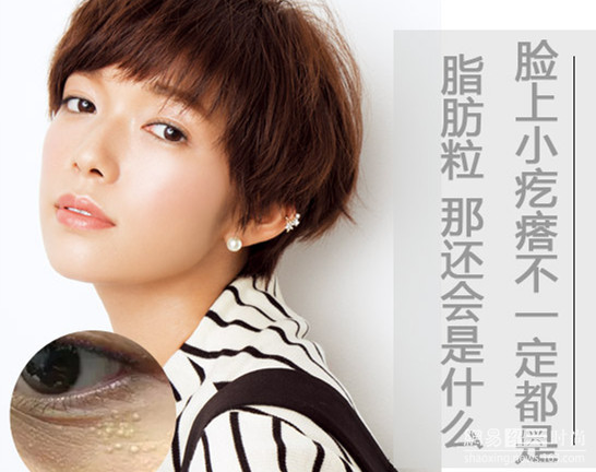 眼睛周围长出的这些小米粒儿,到底是什么呢?