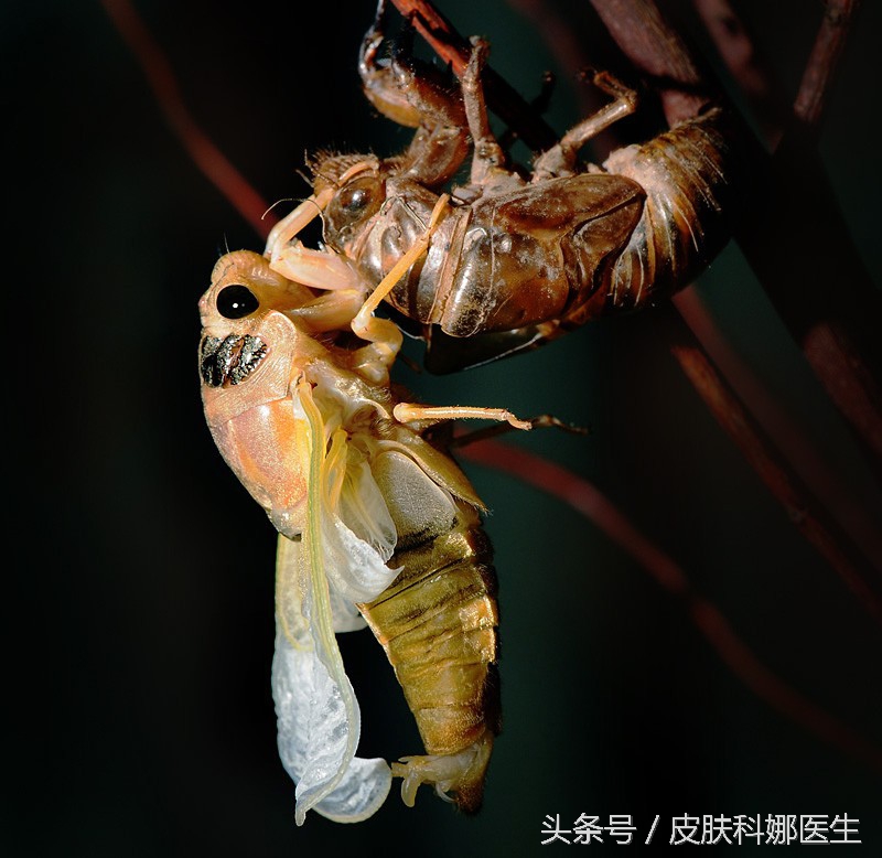 荨麻疹草药治疗法,中药治荨麻疹的最好方法