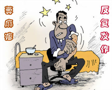 荨麻疹针刺治疗方法,荨麻疹的西医治疗方法