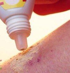 激素类药物忌吃什么食物,激素类药物安全用量