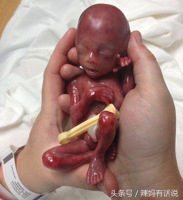 孕33周胎膜早破早产胎儿的成活率,孕妈妈早产会有哪些迹象