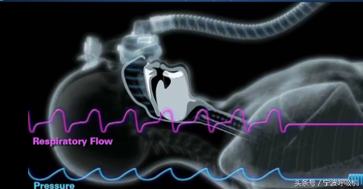 瑞思迈s9autoset-s的价格,瑞思迈s9autoset-s评测