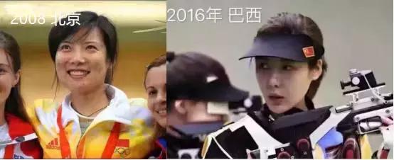 奥运冠军也爱美瘦脸箍牙后她们都美啦