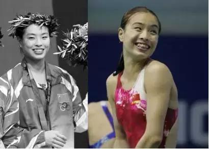 奥运冠军也爱美瘦脸箍牙后她们都美啦