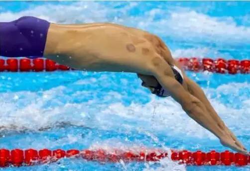 拔罐靠谱吗,拔罐真的有用吗测评