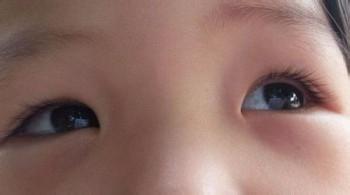 宝宝是个三角眼好丑,宝宝是蓝色眼睛是缺什么吗