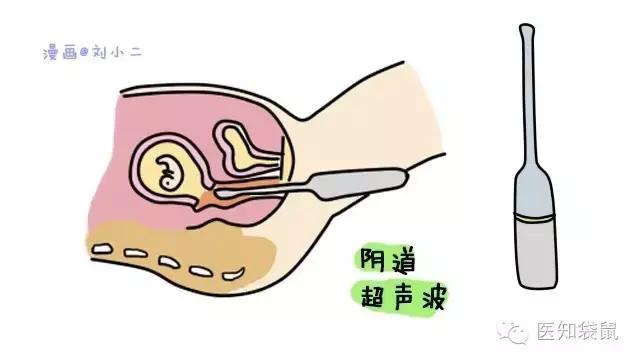 深度解析：普通B超、三维及四维彩超的区别