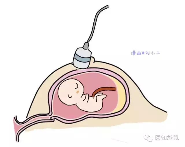 深度解析：普通B超、三维及四维彩超的区别