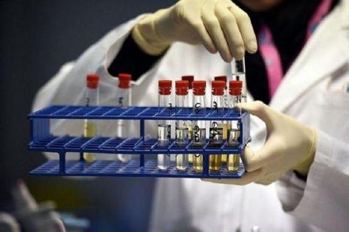 体育运动兴奋剂检测方法,体育运动兴奋剂实例