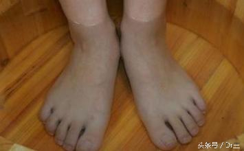 秋天感冒发烧喉咙痛应该怎么办,秋季感冒喉咙痛最快最好方法