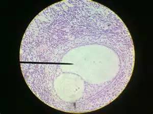 玻璃化冷冻胚胎1和2的区别,玻璃化冷冻卵