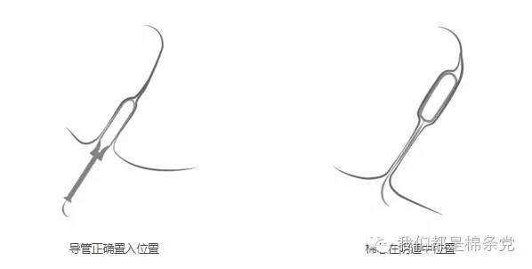 月经期用棉条下水安全么,用月经棉条就可以游泳么